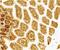 CD209 antigen antibody, PA5-19967, Invitrogen Antibodies, Immunohistochemistry paraffin image 