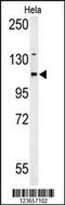 Adenylate Cyclase 4 antibody, 64-161, ProSci, Western Blot image 