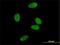 Nuclear Receptor Subfamily 0 Group B Member 2 antibody, H00008431-M01, Novus Biologicals, Immunocytochemistry image 