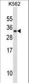 Prolactin antibody, LS-C162158, Lifespan Biosciences, Western Blot image 