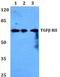 Transforming Growth Factor Beta Receptor 2 antibody, A00759, Boster Biological Technology, Western Blot image 