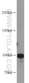 OTU Deubiquitinase 7B antibody, 16605-1-AP, Proteintech Group, Western Blot image 