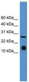 Interleukin 5 antibody, TA335656, Origene, Western Blot image 