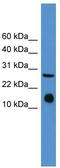 IL5 antibody, TA335656, Origene, Western Blot image 