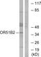 Olfactory receptor 51B1 antibody, GTX87307, GeneTex, Western Blot image 