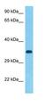 LIM Homeobox 2 antibody, orb333123, Biorbyt, Western Blot image 