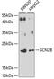 Sodium channel subunit beta-2 antibody, 23-131, ProSci, Western Blot image 