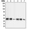 Matrix Metallopeptidase 13 antibody, LS-C352547, Lifespan Biosciences, Western Blot image 