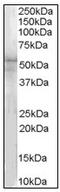 Interleukin 1 Receptor Associated Kinase 4 antibody, AP23599PU-N, Origene, Western Blot image 