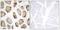 Dihydrouridine Synthase 2 antibody, A30563, Boster Biological Technology, Immunohistochemistry paraffin image 