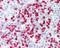 S100 Calcium Binding Protein A8 antibody, 48-769, ProSci, Immunohistochemistry frozen image 