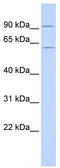 CUGBP Elav-Like Family Member 2 antibody, TA345978, Origene, Western Blot image 