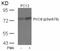 Protein Kinase C Theta antibody, 79-230, ProSci, Western Blot image 