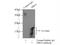 Hemoglobin Subunit Gamma 1 antibody, 25728-1-AP, Proteintech Group, Enzyme Linked Immunosorbent Assay image 