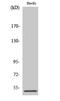 Protein Phosphatase 2 Regulatory Subunit B''Gamma antibody, GTX34137, GeneTex, Western Blot image 