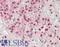 hRAD50 antibody, LS-B12399, Lifespan Biosciences, Immunohistochemistry paraffin image 