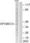 Apolipoprotein B MRNA Editing Enzyme Catalytic Polypeptide Like 4 antibody, abx014759, Abbexa, Western Blot image 