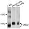 G Protein Subunit Gamma 2 antibody, STJ112347, St John