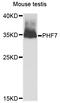 PHD Finger Protein 7 antibody, STJ110517, St John