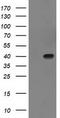 Sulfotransferase 1C2 antibody, LS-C172835, Lifespan Biosciences, Western Blot image 