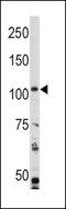 Phosphatidylinositol-4,5-Bisphosphate 3-Kinase Catalytic Subunit Alpha antibody, MBS9204098, MyBioSource, Western Blot image 