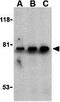 Bruton Tyrosine Kinase antibody, GTX31694, GeneTex, Western Blot image 