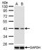 TAR DNA Binding Protein antibody, MA5-27828, Invitrogen Antibodies, Western Blot image 