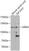 Glutamate Metabotropic Receptor 4 antibody, 22-834, ProSci, Western Blot image 