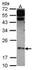 Claudin 4 antibody, NBP2-15911, Novus Biologicals, Western Blot image 