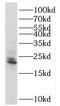 Ras-related protein Rab-18 antibody, FNab06998, FineTest, Western Blot image 