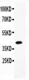 NEDD8 Activating Enzyme E1 Subunit 1 antibody, LS-C357525, Lifespan Biosciences, Western Blot image 