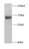 PHD Finger Protein 19 antibody, FNab06383, FineTest, Western Blot image 