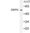 DM1 Protein Kinase antibody, LS-C176924, Lifespan Biosciences, Western Blot image 