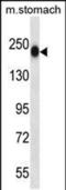 Tenascin N antibody, PA5-48606, Invitrogen Antibodies, Western Blot image 