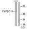 Cytochrome P450 Family 2 Subfamily C Member 18 antibody, A07005, Boster Biological Technology, Western Blot image 