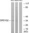 Olfactory Receptor Family 51 Subfamily G Member 2 antibody, A30876, Boster Biological Technology, Western Blot image 