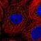 CTD Small Phosphatase 2 antibody, NBP1-85958, Novus Biologicals, Immunofluorescence image 