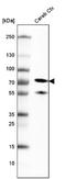 Neurofilament Light antibody, NBP2-59061, Novus Biologicals, Western Blot image 