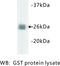 Hematopoietic Prostaglandin D Synthase antibody, MBS355191, MyBioSource, Western Blot image 
