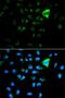 Transmembrane Protein 259 antibody, orb324516, Biorbyt, Immunofluorescence image 