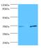 Plasminogen Activator, Urokinase Receptor antibody, MBS1490474, MyBioSource, Western Blot image 