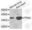 Tropomyosin 4 antibody, A4166, ABclonal Technology, Western Blot image 