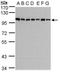 HPS3 Biogenesis Of Lysosomal Organelles Complex 2 Subunit 1 antibody, TA308334, Origene, Western Blot image 