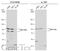 Inhibitor Of Nuclear Factor Kappa B Kinase Subunit Beta antibody, GTX110598, GeneTex, Western Blot image 