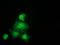 Glutathione S-Transferase Theta 2 (Gene/Pseudogene) antibody, LS-C172409, Lifespan Biosciences, Immunofluorescence image 