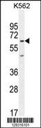 Kelch Like Family Member 40 antibody, MBS9215030, MyBioSource, Western Blot image 