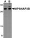 Nipsnap Homolog 3B antibody, LS-B3867, Lifespan Biosciences, Western Blot image 