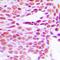 Histone Cluster 1 H1 Family Member B antibody, orb214030, Biorbyt, Immunohistochemistry paraffin image 