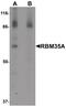 Epithelial Splicing Regulatory Protein 1 antibody, PA5-21109, Invitrogen Antibodies, Western Blot image 