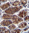 Cellular Communication Network Factor 2 antibody, abx033676, Abbexa, Immunohistochemistry paraffin image 